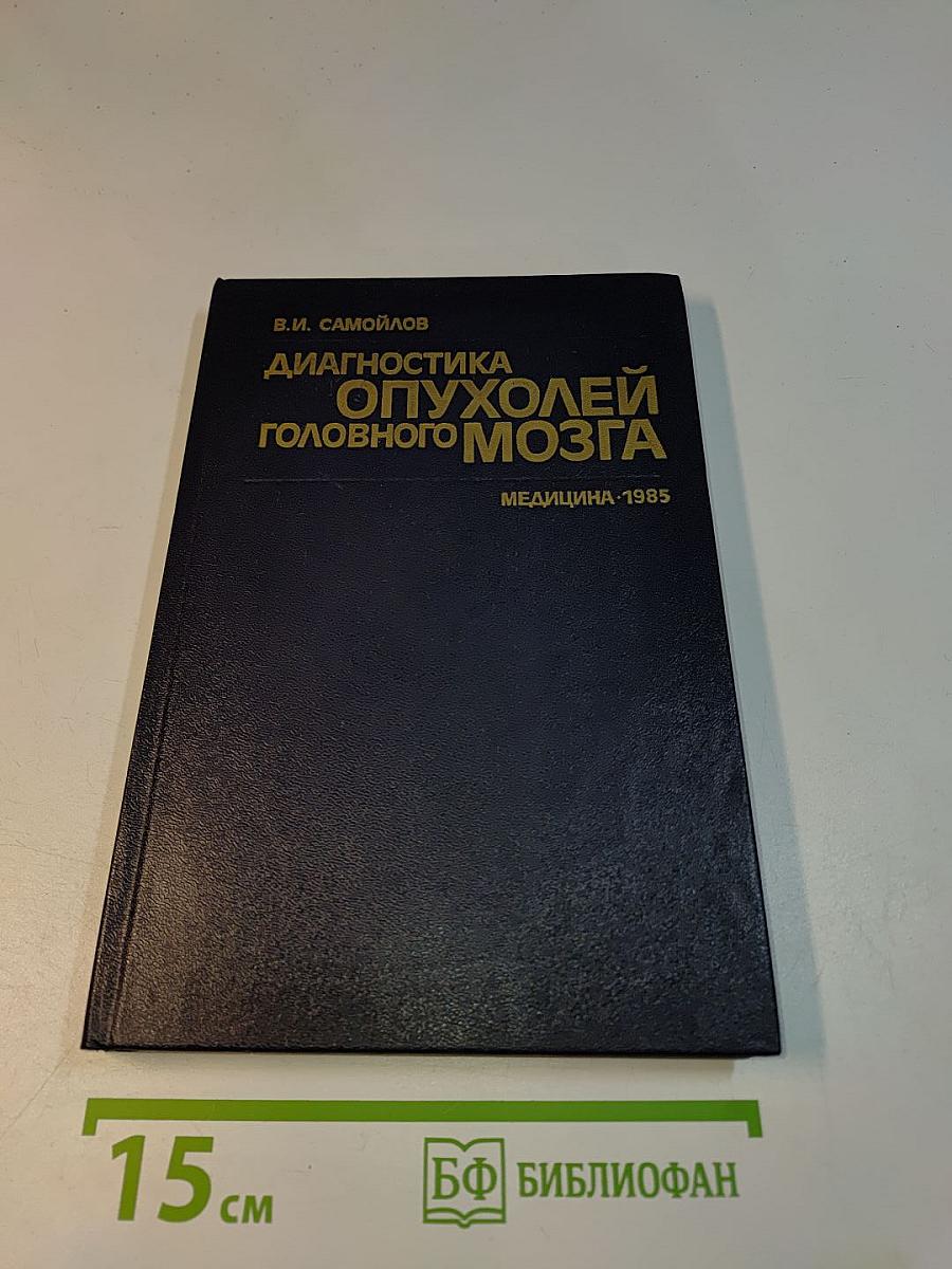 Диагностика опухолей головного мозга