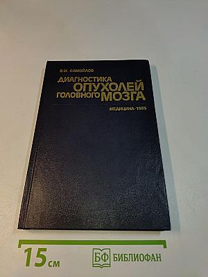 Диагностика опухолей головного мозга