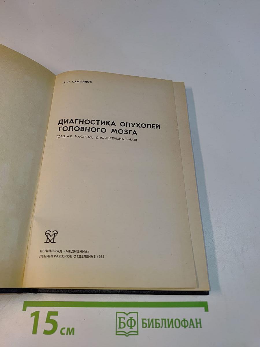Диагностика опухолей головного мозга