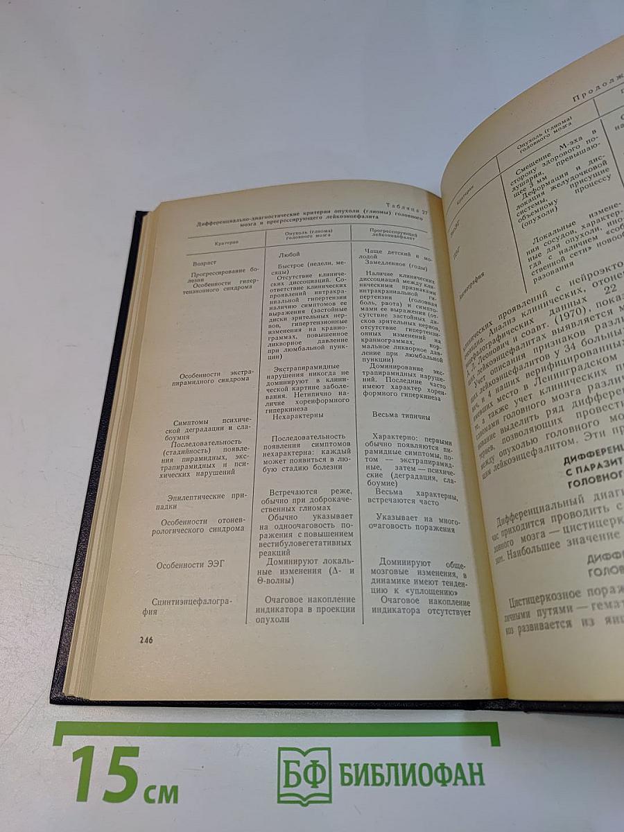Диагностика опухолей головного мозга
