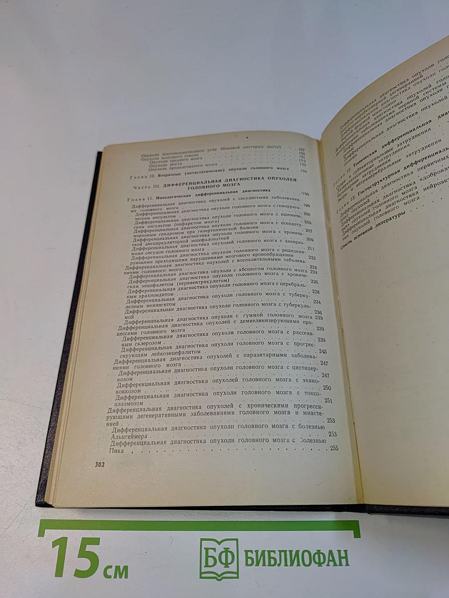 Диагностика опухолей головного мозга