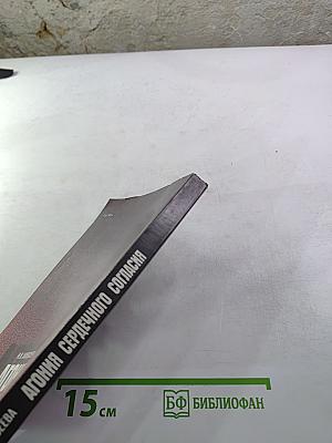 Агония сердечного согласия