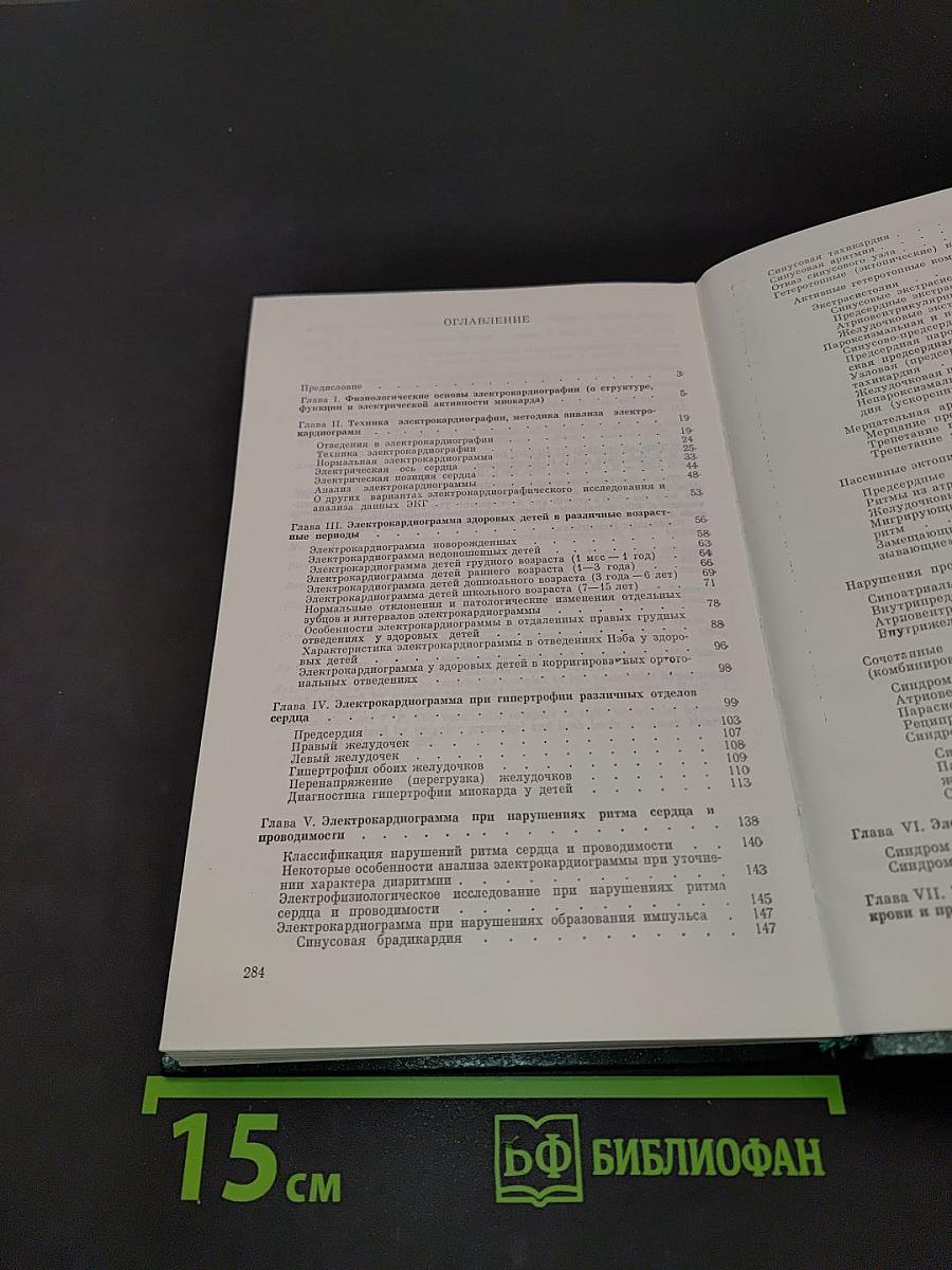 Электрокардиография у детей