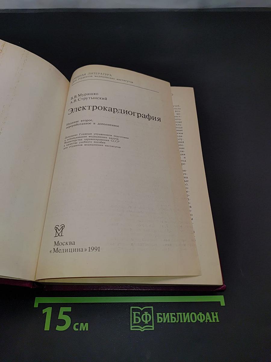 Электрокардиография