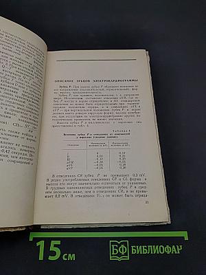 Практический анализ электрокардиограмм