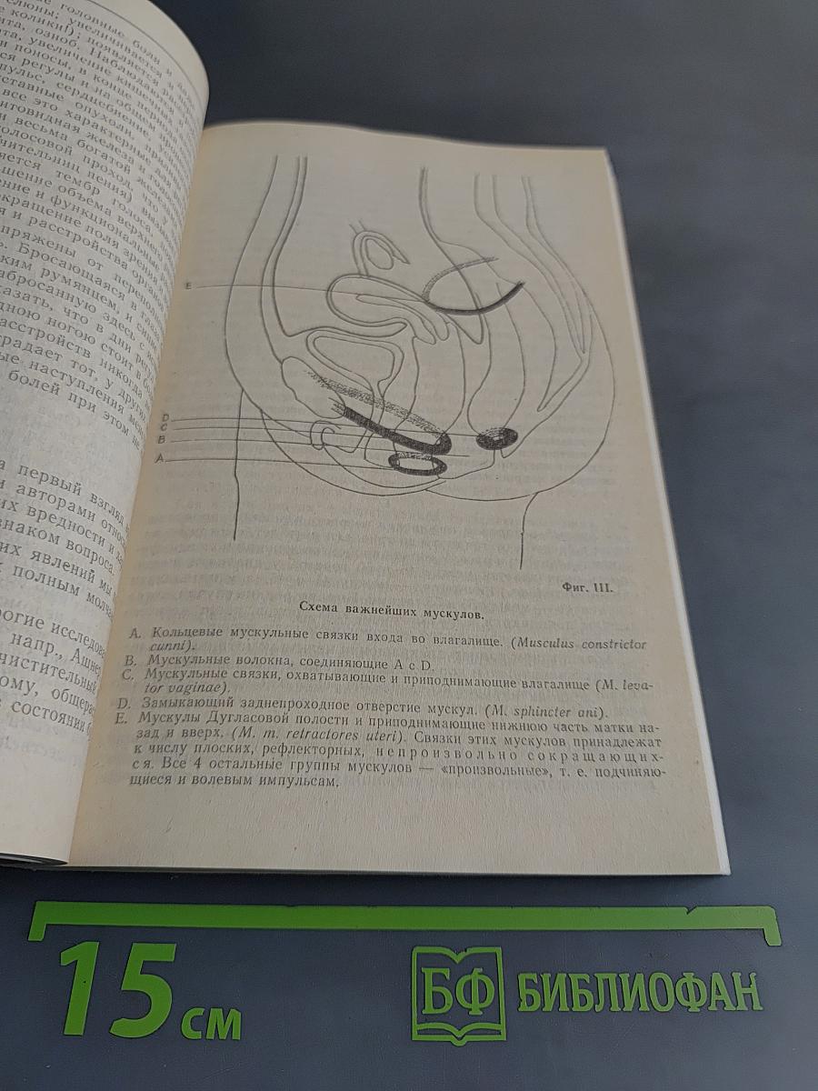 Техника брака