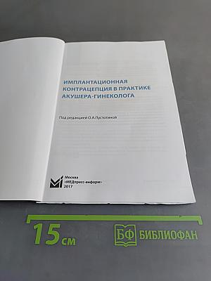 Имплантационная контрацепция в практике акушера-гинеколога