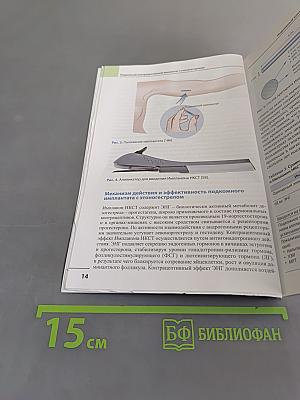 Имплантационная контрацепция в практике акушера-гинеколога