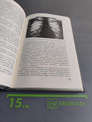 Туберкулез