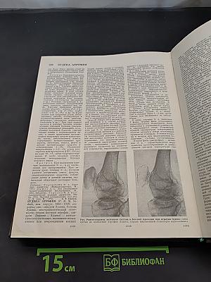 Большая медицинская энциклопедия. Том 8. Евгеника – Зыбление