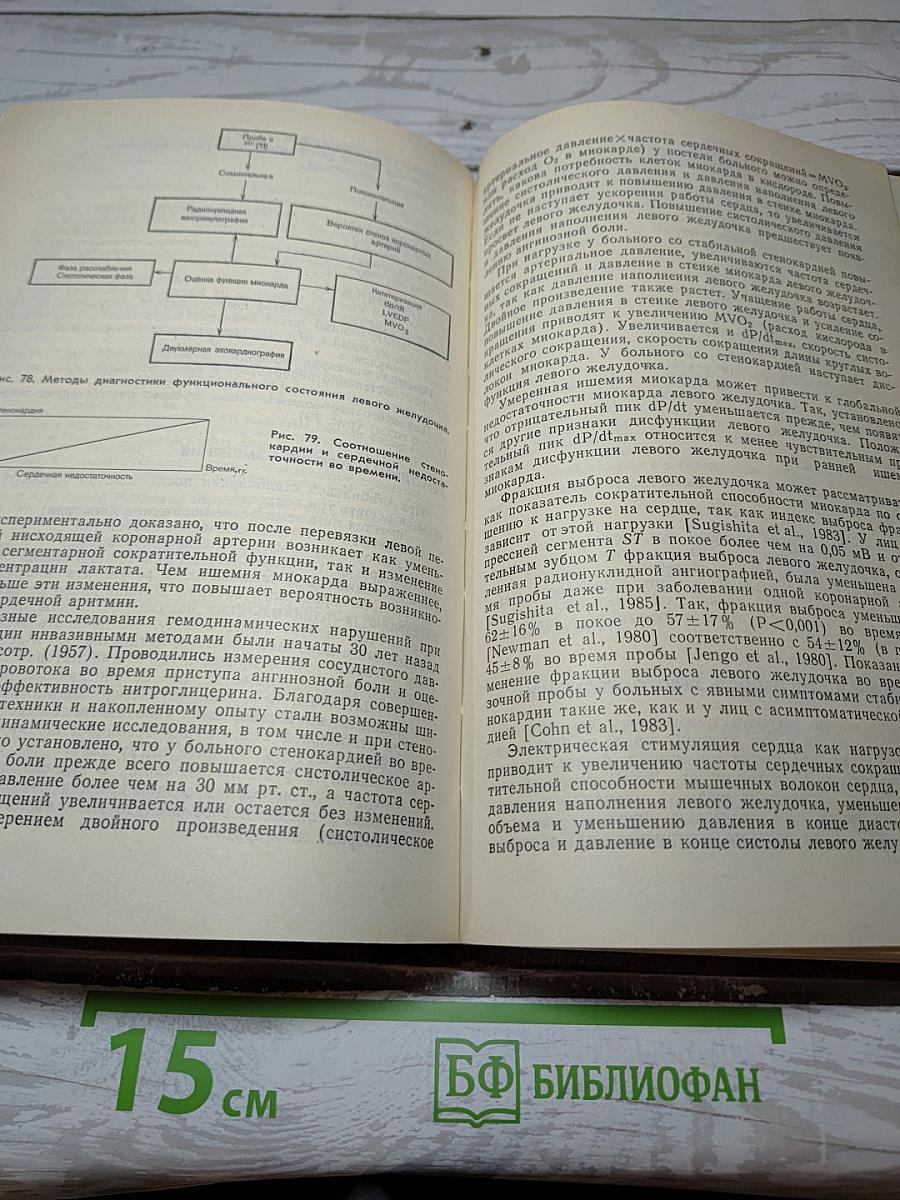 Стенокардия