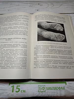Кожные и венерические болезни у детей