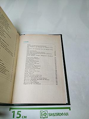 Болезни печени (Руководство для врачей)