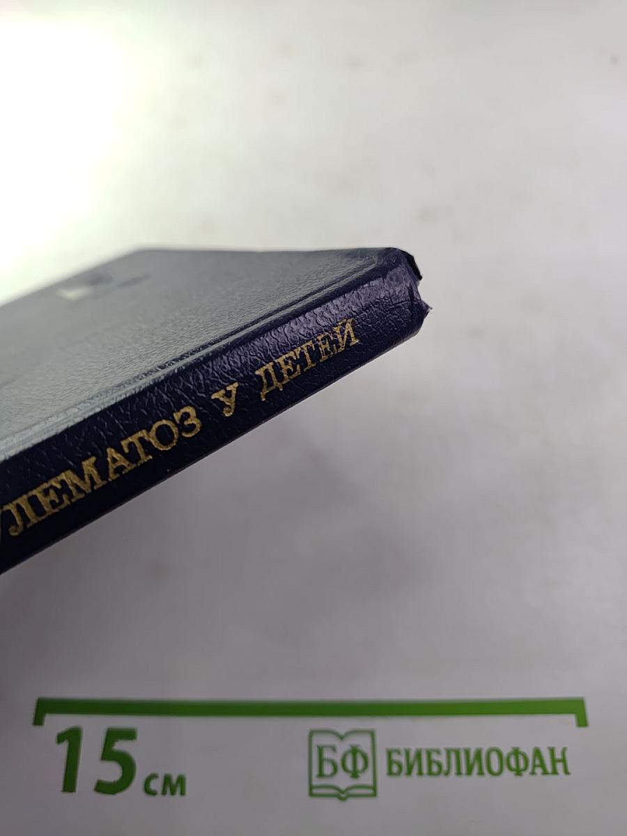 Лимфогранулематоз у детей