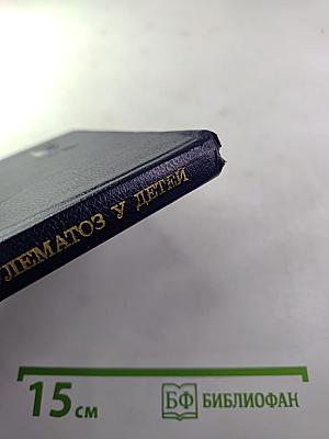 Лимфогранулематоз у детей