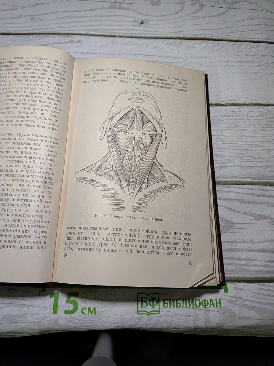 Трахеотомия