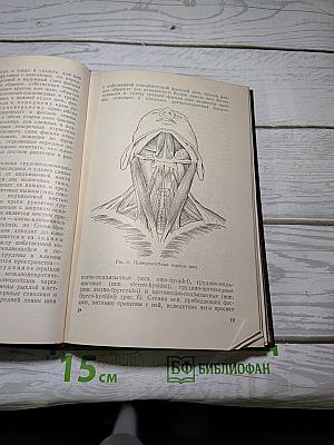 Трахеотомия