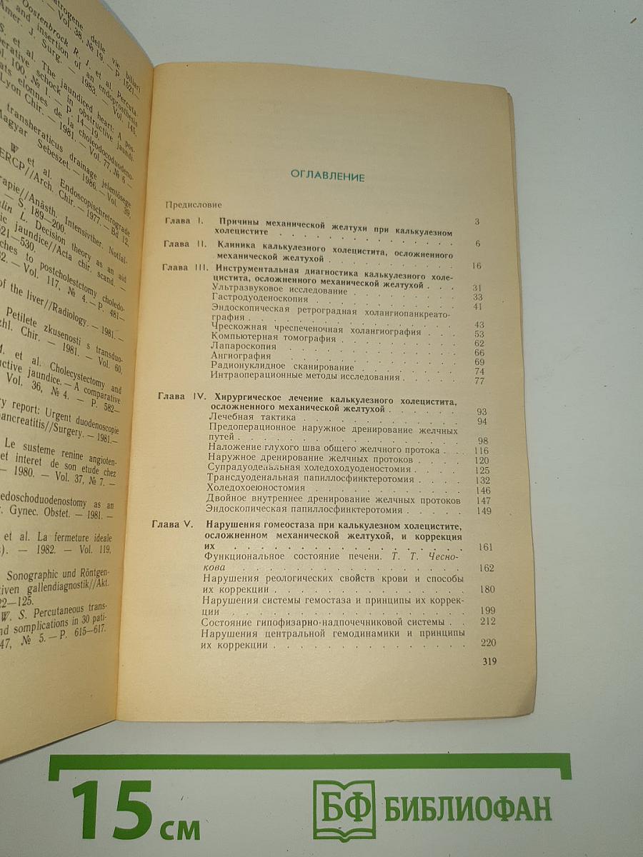 Калькулезный холецистит