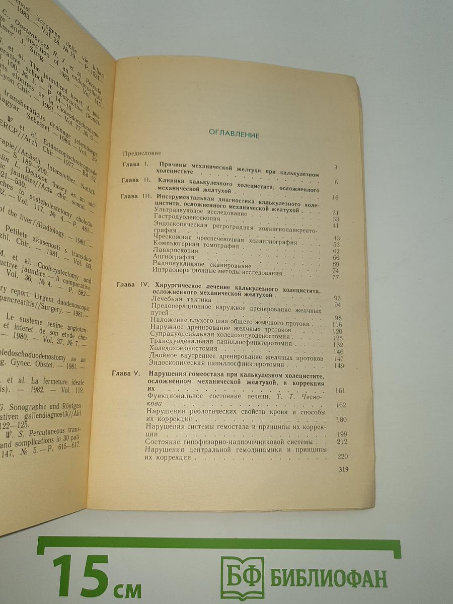 Калькулезный холецистит