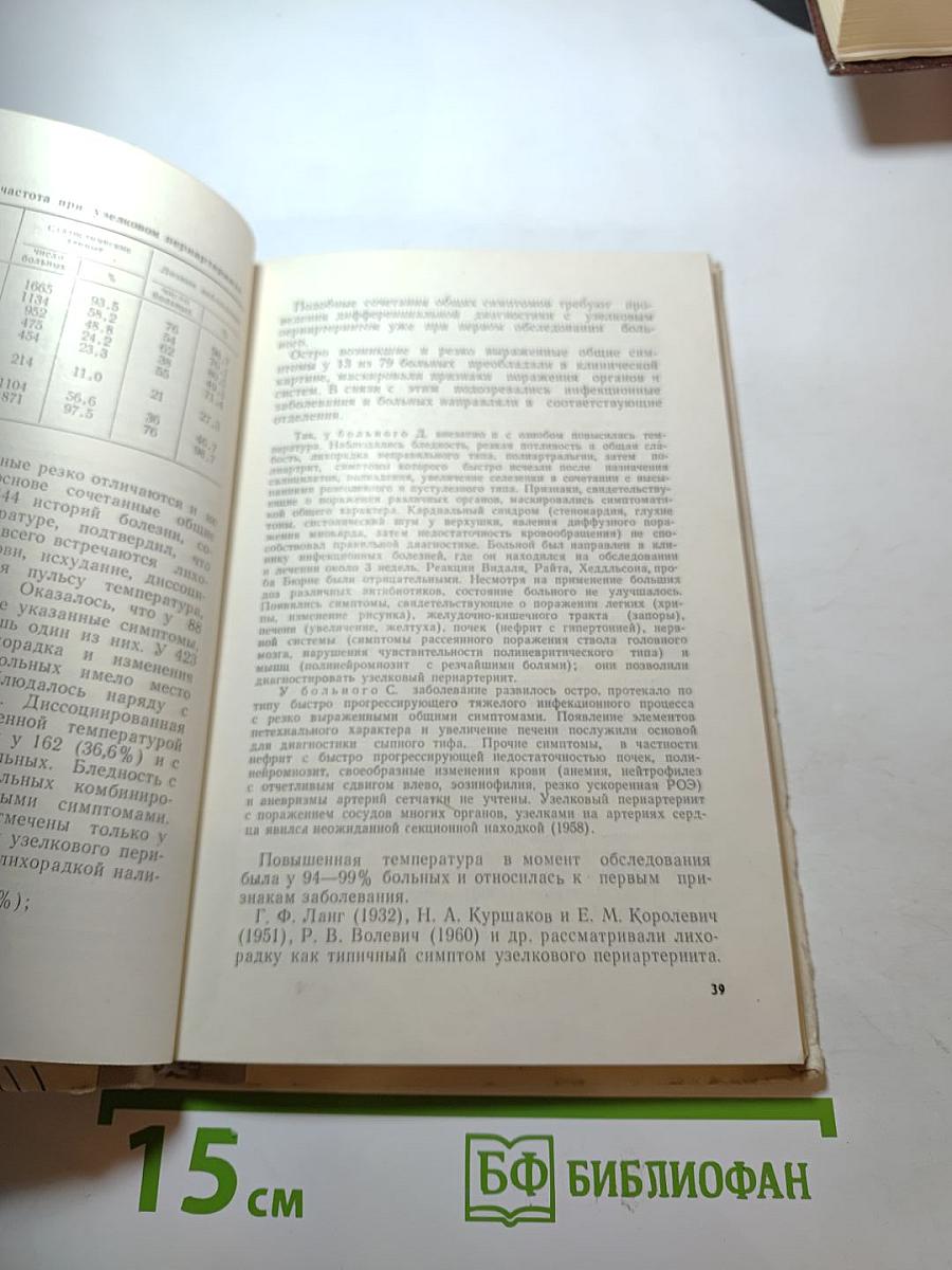 Узелковый периартериит