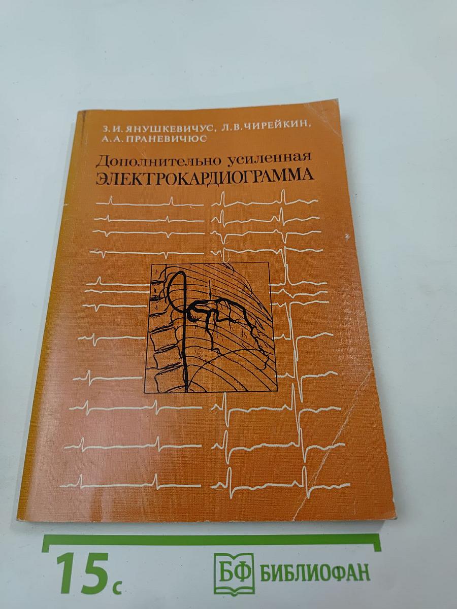 Дополнительно усиленная электрокардиограмма