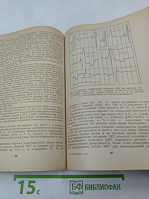 Дополнительно усиленная электрокардиограмма