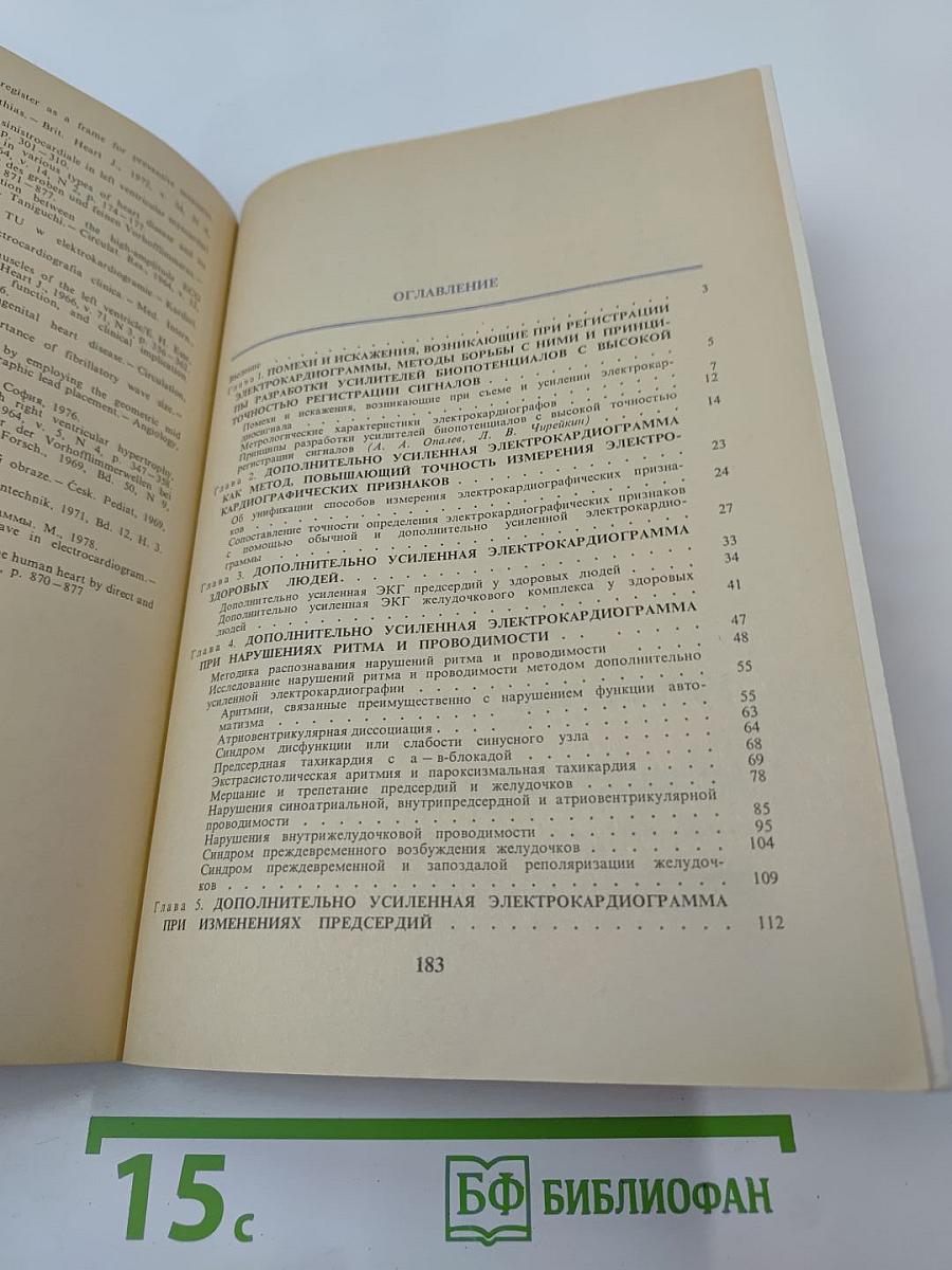 Дополнительно усиленная электрокардиограмма