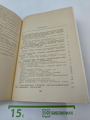 Дополнительно усиленная электрокардиограмма