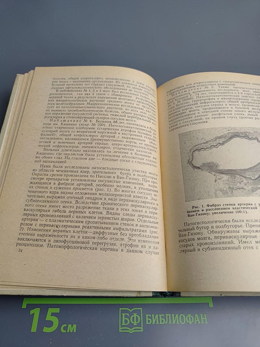 Ученые записки. Выпуск 13. Глаукома