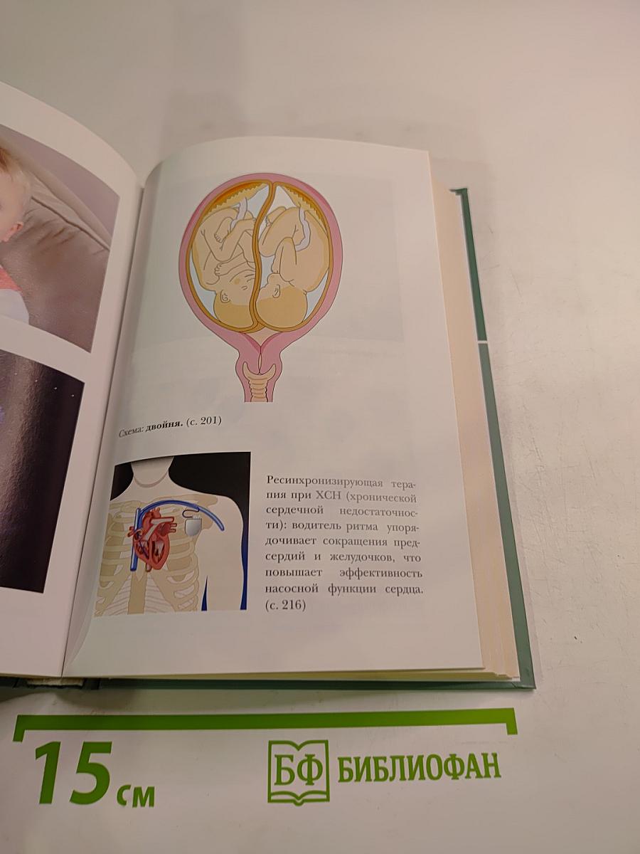 Большая медицинская энциклопедия. Том 4: Гид-Дел