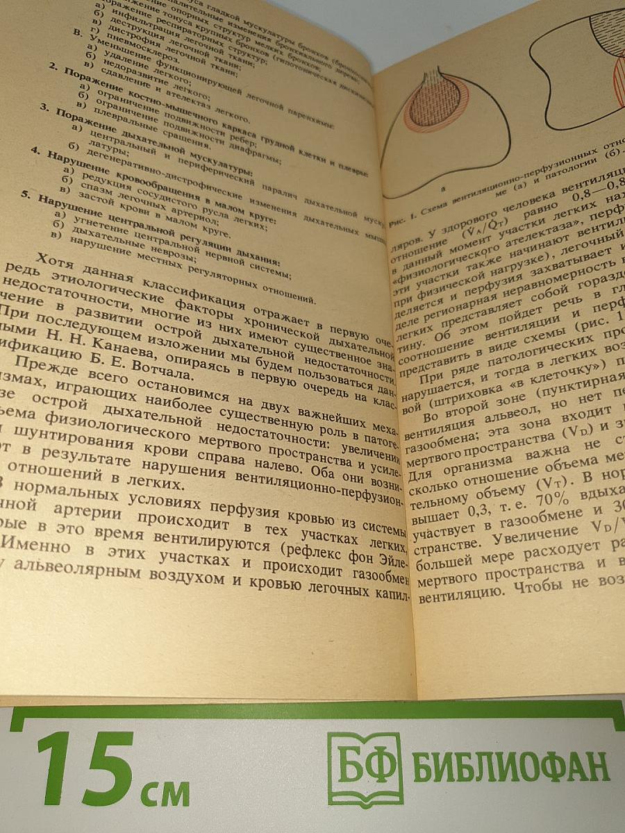 Искусственная вентиляция легких в интенсивной терапии
