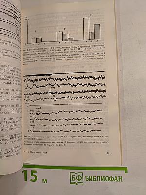 Биоэлектрохимическая активность головного мозга при обучении