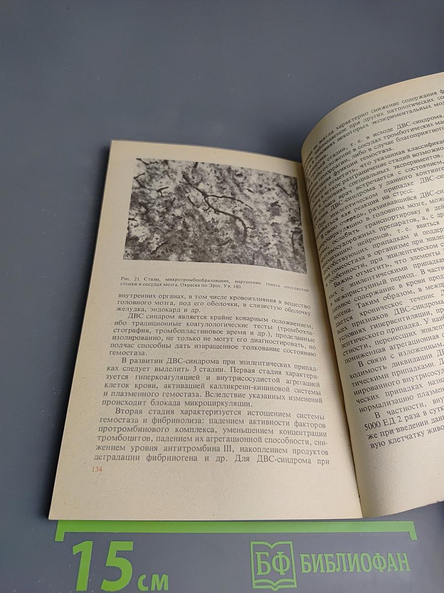 Неотложная помощь при судорожных состояниях