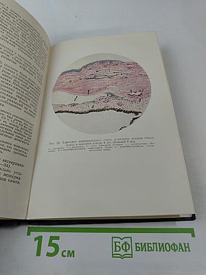 Осколки стекла и камня в глазу