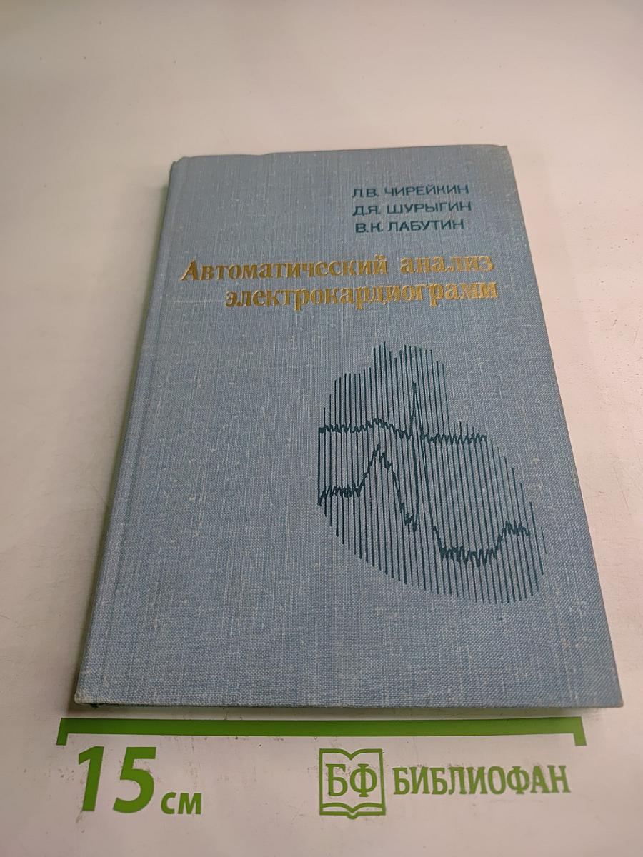 Автоматический анализ электрокардиограмм