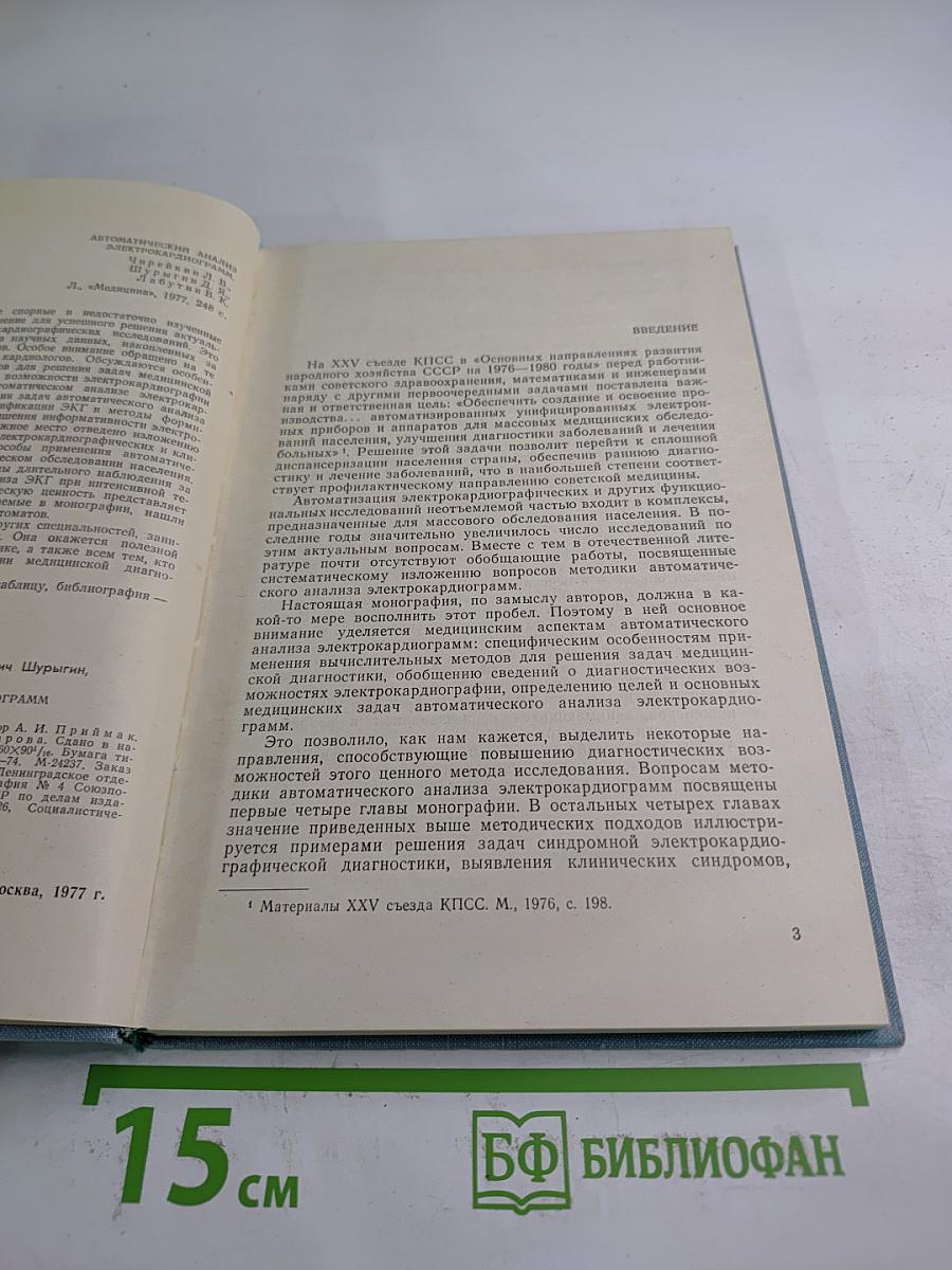 Автоматический анализ электрокардиограмм