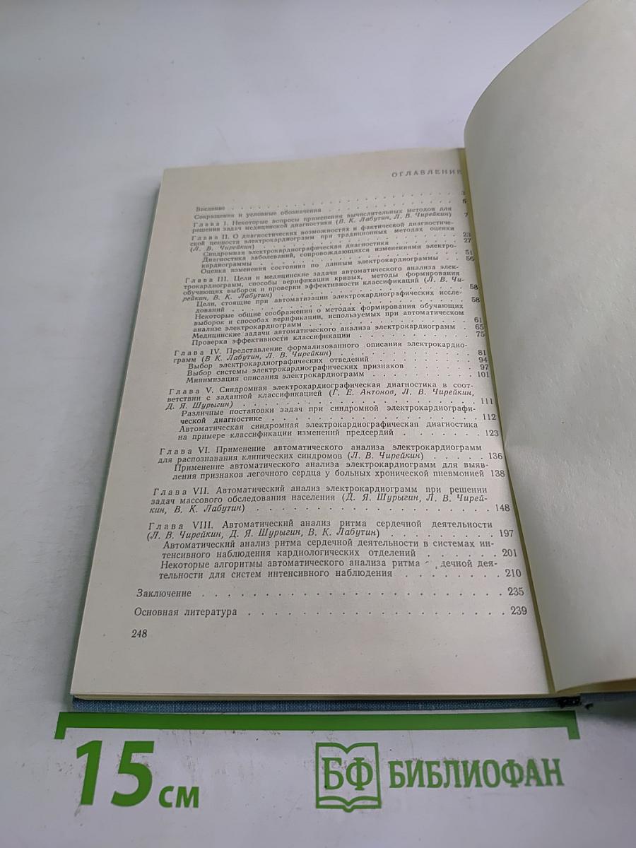 Автоматический анализ электрокардиограмм