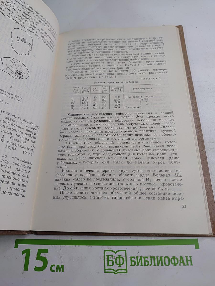 Материалы к изучению реакций центральной нервной системы человека на проникающее излучение