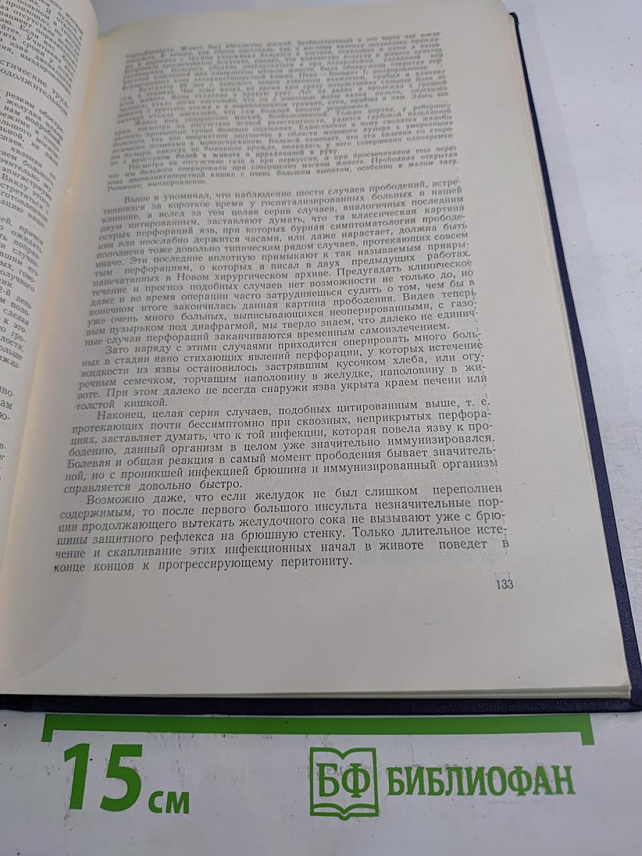 Хирургия язвенной болезни желудка и нейро-гуморальная регуляция желудочной секреции у человека