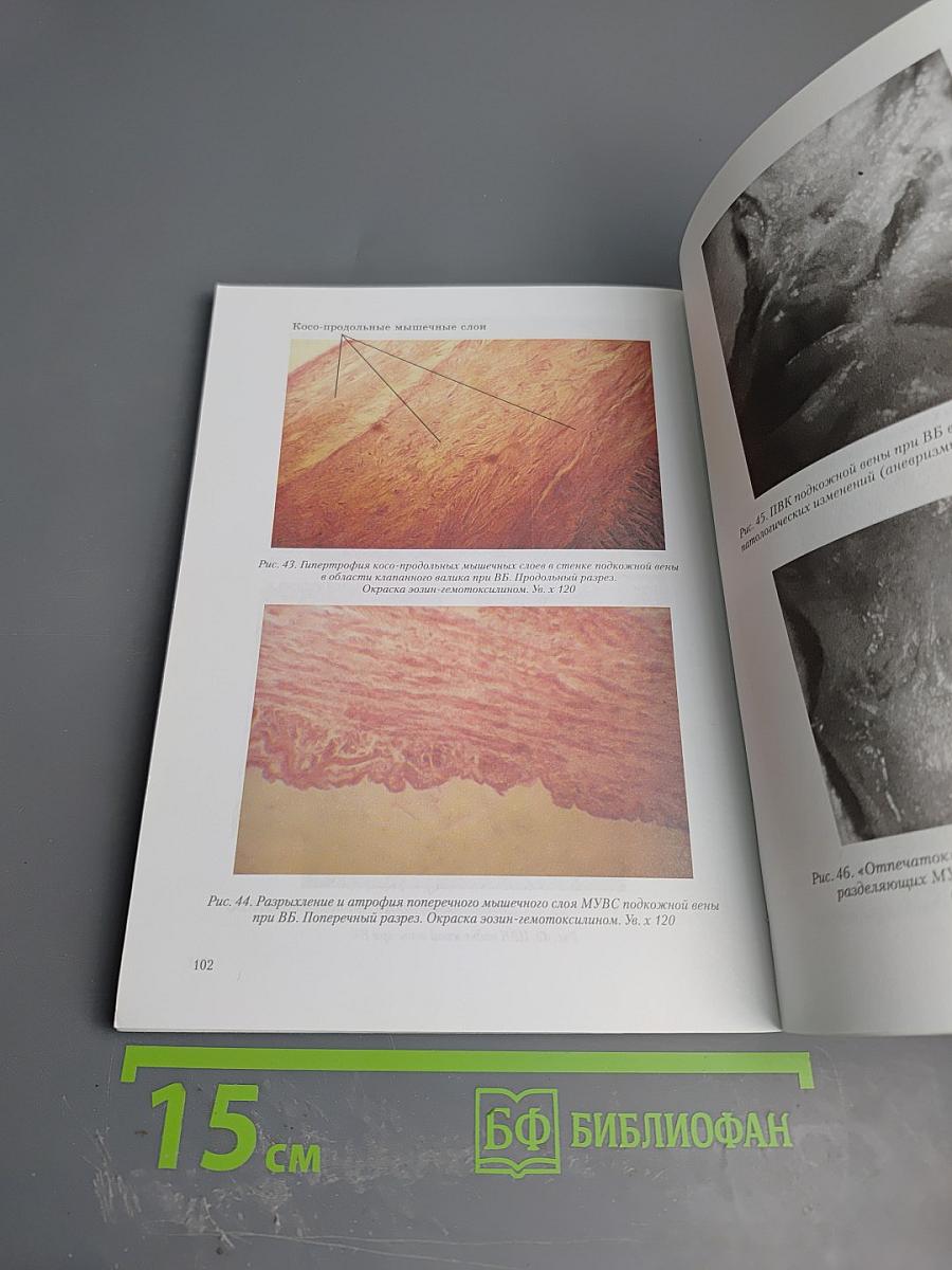 Трактат о венозном клапане человека