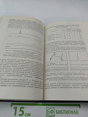 Кортико-висцеральная теория патогенеза язвенной болезни