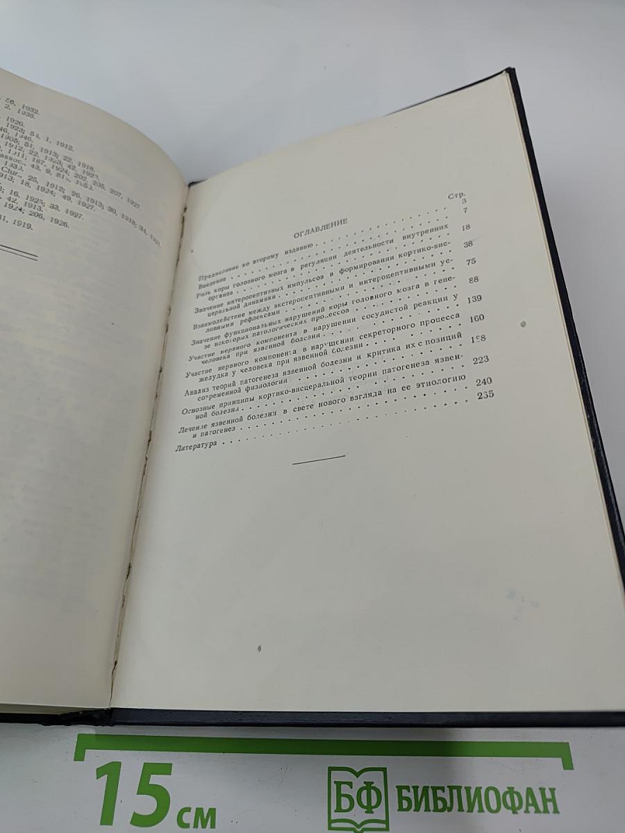 Кортико-висцеральная теория патогенеза язвенной болезни