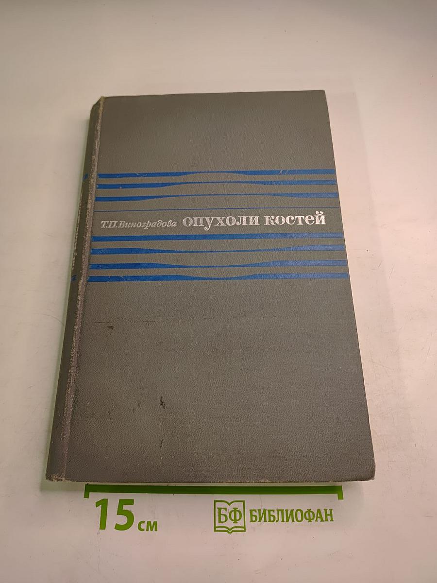 Опухоли костей