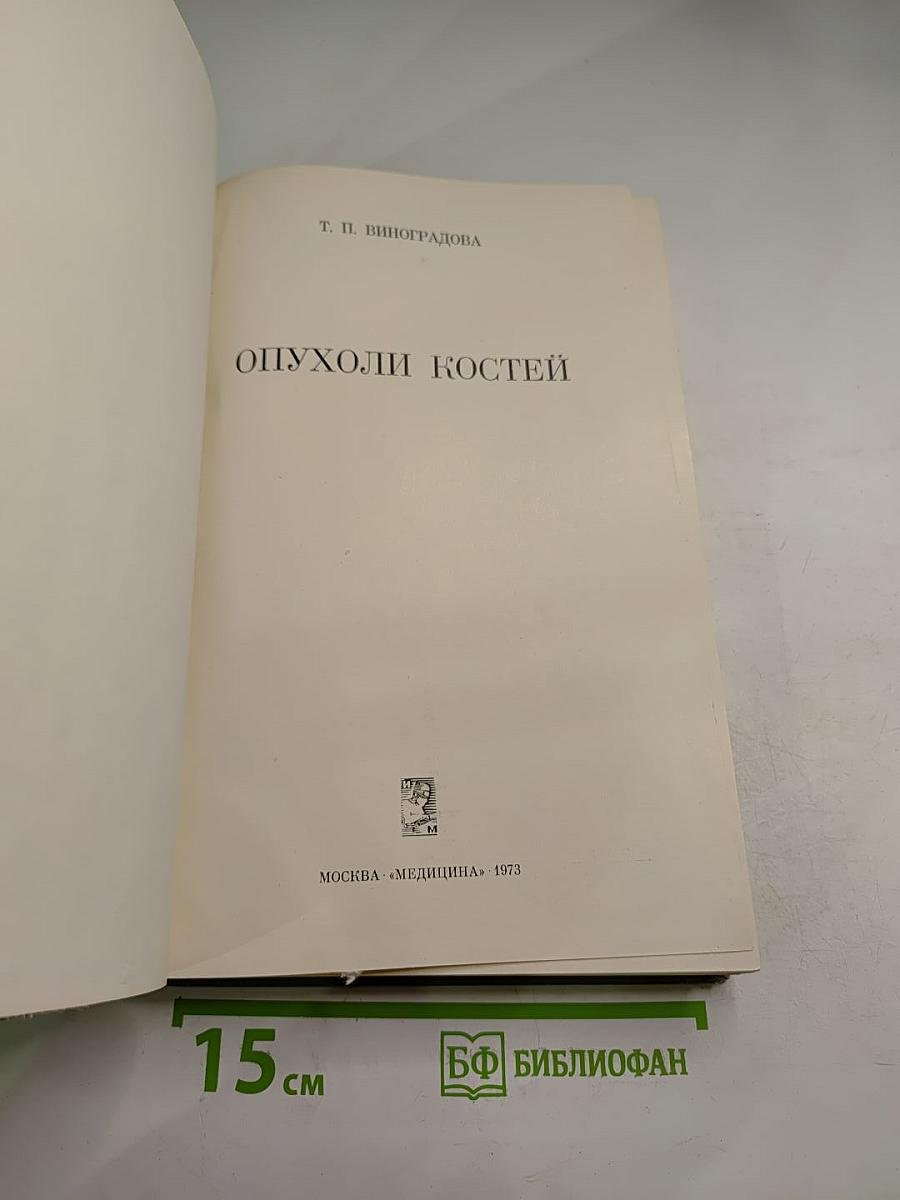 Опухоли костей