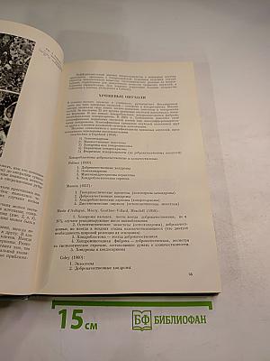 Опухоли костей