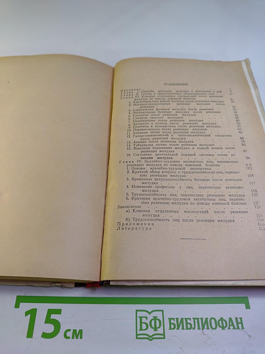 Клиника и трудоспособность после резекции желудка при язвенной болезни