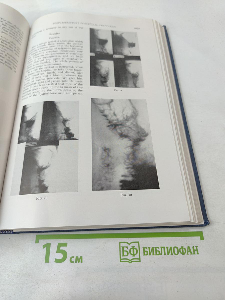World Congress of Gastroenterology and Fifty-ninth Annual Meeting of the American Gastroenterological Association 1958. Volume II