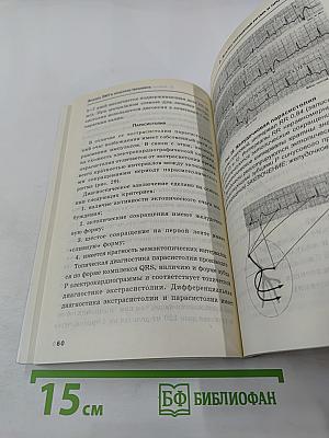 Анализ ЭКГ в практике терапевта