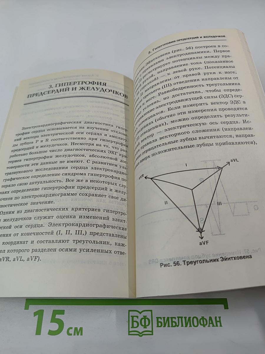 Анализ ЭКГ в практике терапевта