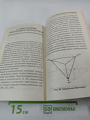 Анализ ЭКГ в практике терапевта